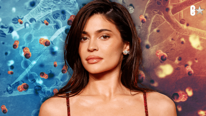 Kylie Jenner stem cell therapy